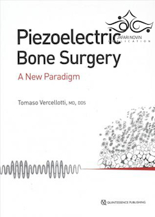 عکس Piezoelectric Bone Surgery: A New Paradigm2020 جراحی پیزوالکتریک استخوان: الگوی جدید