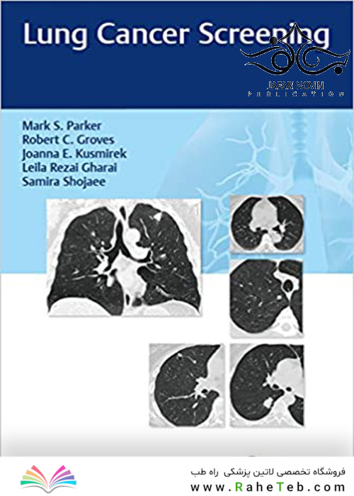 Lung Cancer Screening 1st Edition2017 غربالگری سرطان ریه
