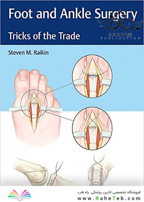 Foot and Ankle Surgery: Tricks of the Trade2018 جراحی پا و مچ پا