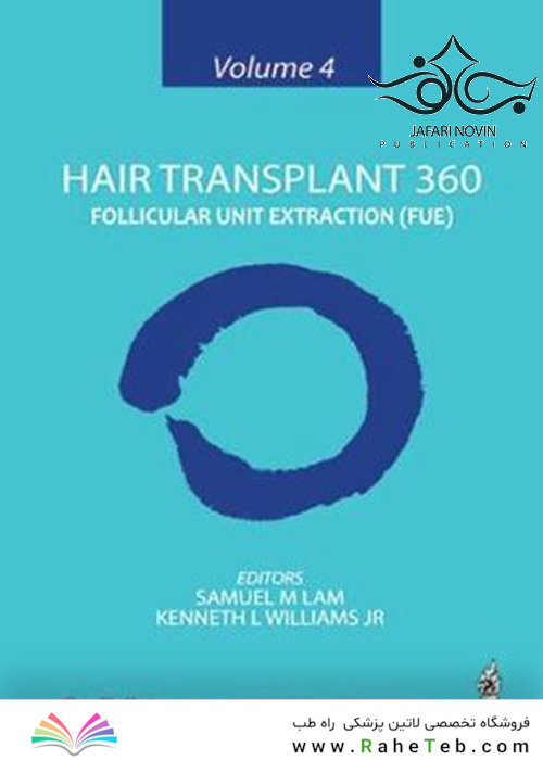 Hair Transplant 360: Follicular Unit Extraction (FUE)2019