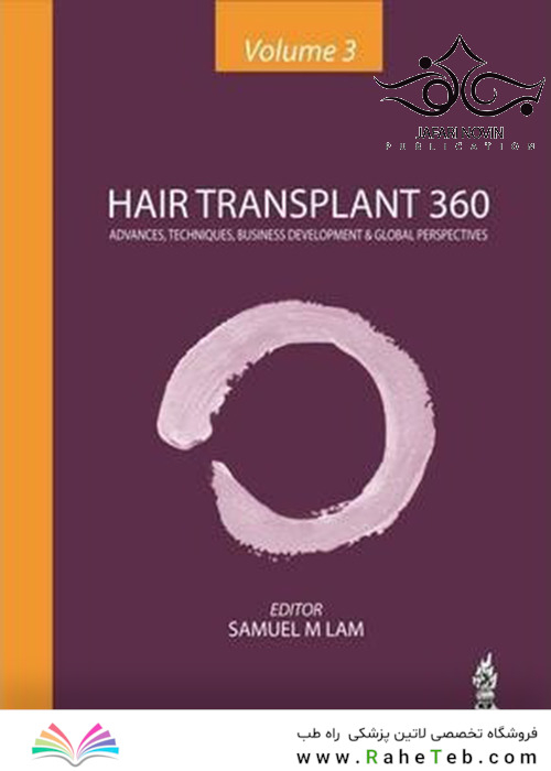 Hair Transplant 360 1st Edition2014