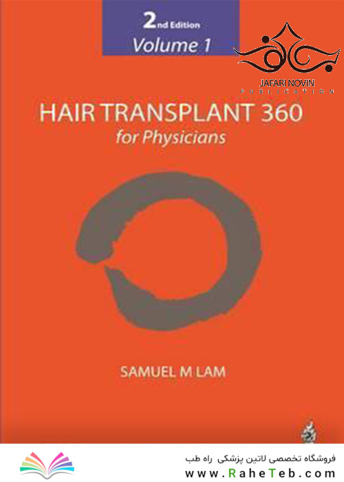 Hair Transplant 360 for Physicians 2nd Edition2019