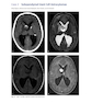 Neurosurgery Case Review: Questions and Answers 2nd Edition 2020