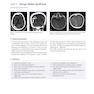 Neurosurgery Case Review: Questions and Answers 2nd Edition 2020