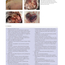 Neurosurgery Case Review: Questions and Answers 2nd Edition 2020