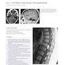 Neurosurgery Case Review: Questions and Answers 2nd Edition 2020