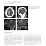 Neurosurgery Case Review: Questions and Answers 2nd Edition 2020
