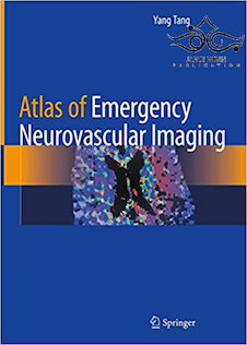 عکس Atlas of Emergency Neurovascular Imaging2020 اطلس تصویربرداری عصبی عروقی اضطراری