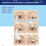 Ophthalmic Plastic Surgery of the Upper Face2019 جراحی پلاستیک چشم از قسمت فوقانی صورت