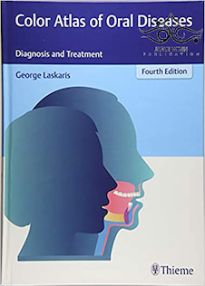 عکس Color Atlas of Oral Diseases: Diagnosis and Treatment 4th Edicion 2017