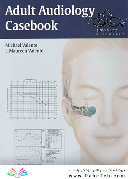 Adult Audiology Casebook 1st Edition2015 موردی شنوایی شناسی بزرگسالان