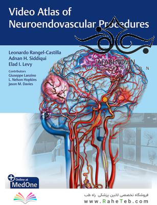 Video Atlas of Neuroendovascular Procedures 1st Edition2020 اطلس ویدئویی روشهای عصبی