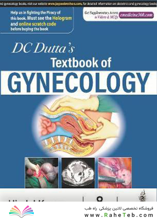 DC Dutta’s Textbook of Gynecology, 8th Edition2020