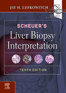 عکس Scheuer’s Liver Biopsy Interpretation 10th Edition 2020