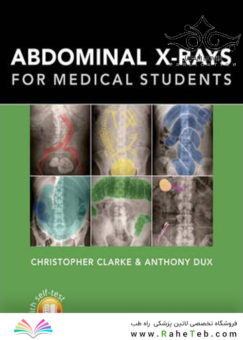 Abdominal X-rays for Medical Student2015
