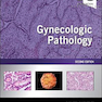Gynecologic Pathology, 2nd Edition2020