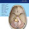 Comprehensive Management of Vestibular Schwannoma 1st Edition2019 مدیریت جامع شوانوم دهلیزی