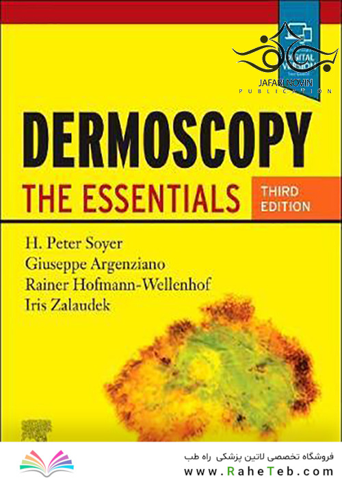 Dermoscopy: The Essentials, 3rd Edition