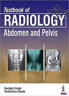 عکس Textbook of Radiology: Abdomen and Pelvis, 1st Edition2017 رادیولوژی: شکم و لگن