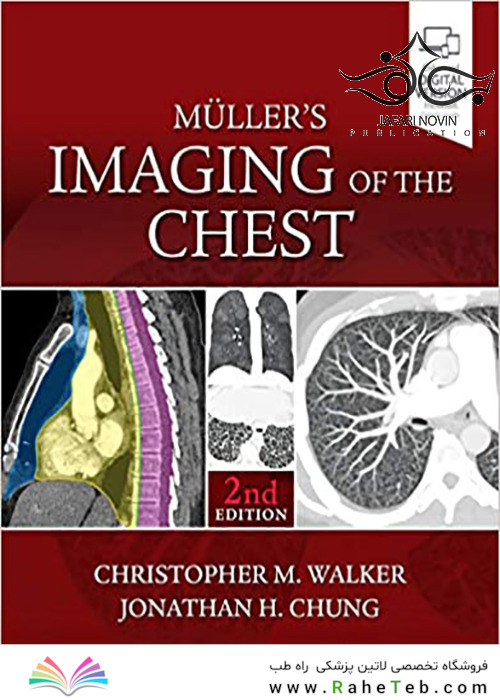 Muller’s Imaging of the Chest, 2nd Edition2018