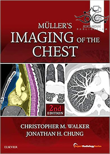 عکس Muller’s Imaging of the Chest, 2nd Edition2018