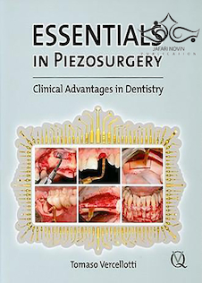عکس Essentials in Piezosurgery, 1st Edition2009 موارد ضروری در جراحی پیزو