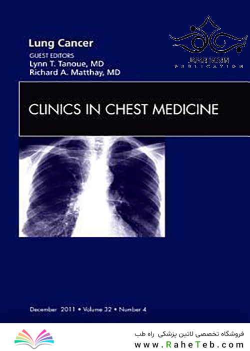 Lung Cancer (Volume 32-4), 1st Edition2011 سرطان ریه (جلد 32-4)