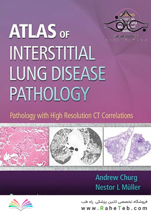 Atlas of Interstitial Lung Disease Pathology 2014