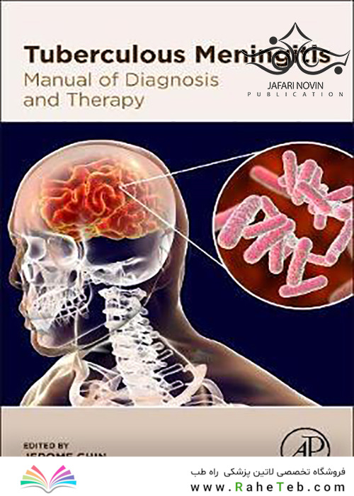 Tuberculous-Meningitis2020 مننژیت سل