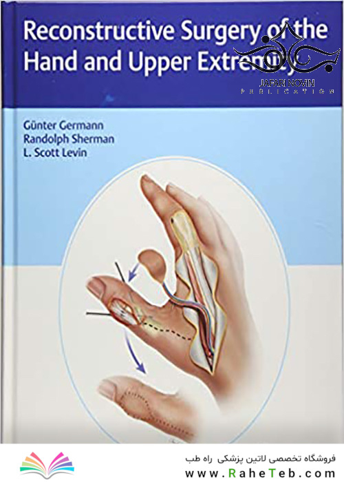 Reconstructive Surgery of the Hand and Upper Extremity2017 جراحی ترمیمی دست و اندام فوقانی