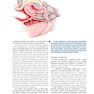 Berek - Novak’s Gynecology Essentials2020