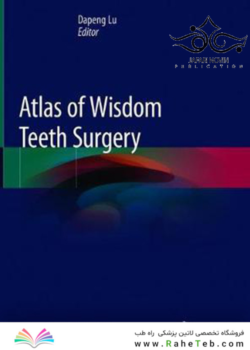 Atlas of Wisdom Teeth Surgery2019