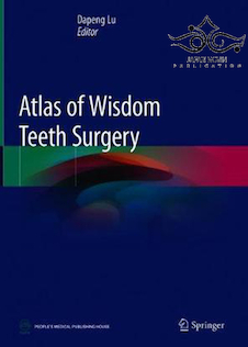عکس Atlas of Wisdom Teeth Surgery2019