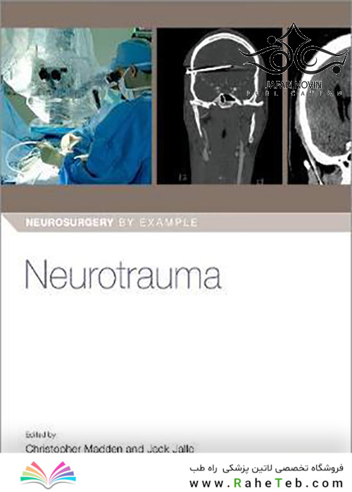Neurotrauma-(Neurosurgery-by-Example)2020 جراحی مغز و اعصاب