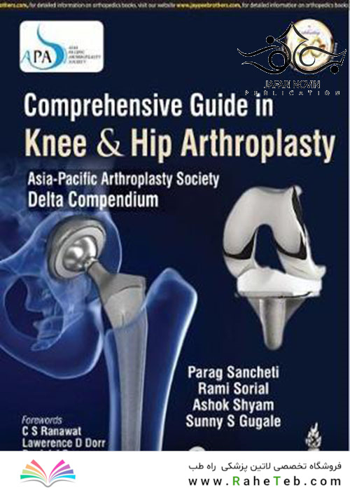 Comprehensive Guide In Knee - Hip Arthroplasty