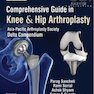 Comprehensive Guide In Knee - Hip Arthroplasty