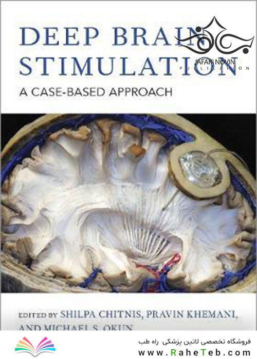 Deep Brain Stimulation: A Case-based Approach 1st Edition