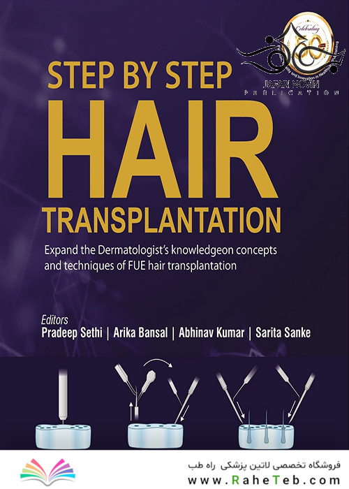 Step by Step Hair Transplantation 2019 کاشت مو به صورت مرحله به مرحله