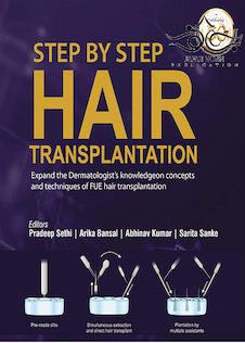 عکس Step by Step Hair Transplantation 2019
