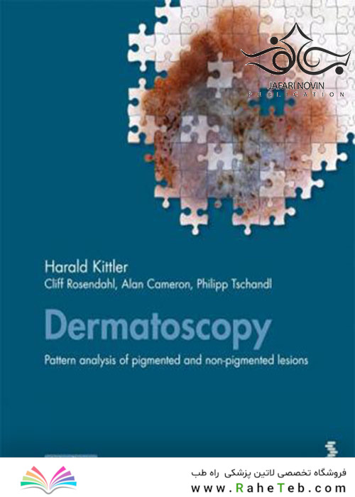 Dermatoscopy: Pattern analysis of pigmented and non-pigmented lesions
