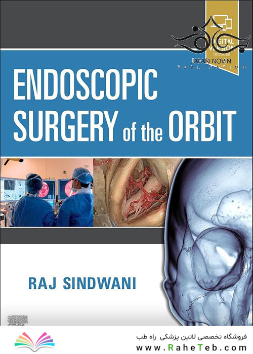 Endoscopic Surgery of the Orbit 1st Edition