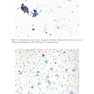 The Bethesda System for Reporting Cervical Cytology, 3rd Edition 2015