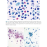 The Bethesda System for Reporting Cervical Cytology, 3rd Edition 2015