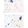 The Bethesda System for Reporting Cervical Cytology, 3rd Edition 2015