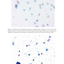 The Bethesda System for Reporting Cervical Cytology, 3rd Edition 2015