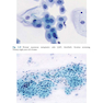 The Bethesda System for Reporting Cervical Cytology, 3rd Edition 2015