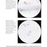 The Bethesda System for Reporting Cervical Cytology, 3rd Edition 2015