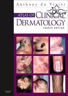 عکس Atlas of Clinical Dermatology, 4th Edition