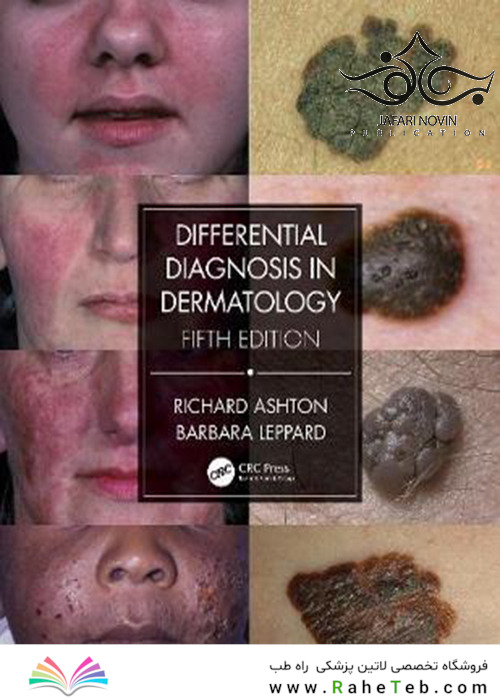 Differential Diagnosis in Dermatology, 5th Edition2021 تشخیص افتراقی در پوست