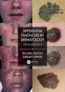 عکس Differential Diagnosis in Dermatology, 5th Edition2021 تشخیص افتراقی در پوست